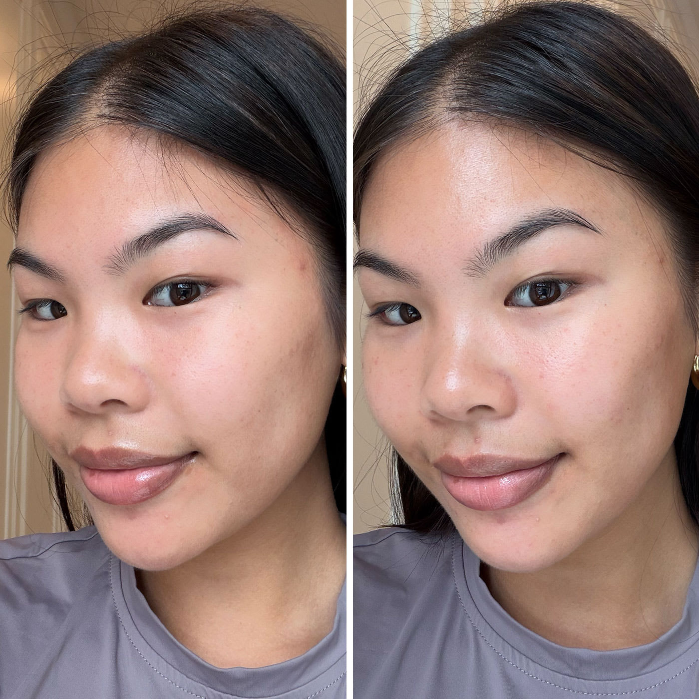 Woman with straight black hair tied back, wearing a grey top, shown before and after treatment. The photos highlight smoother skin and an even complexion.